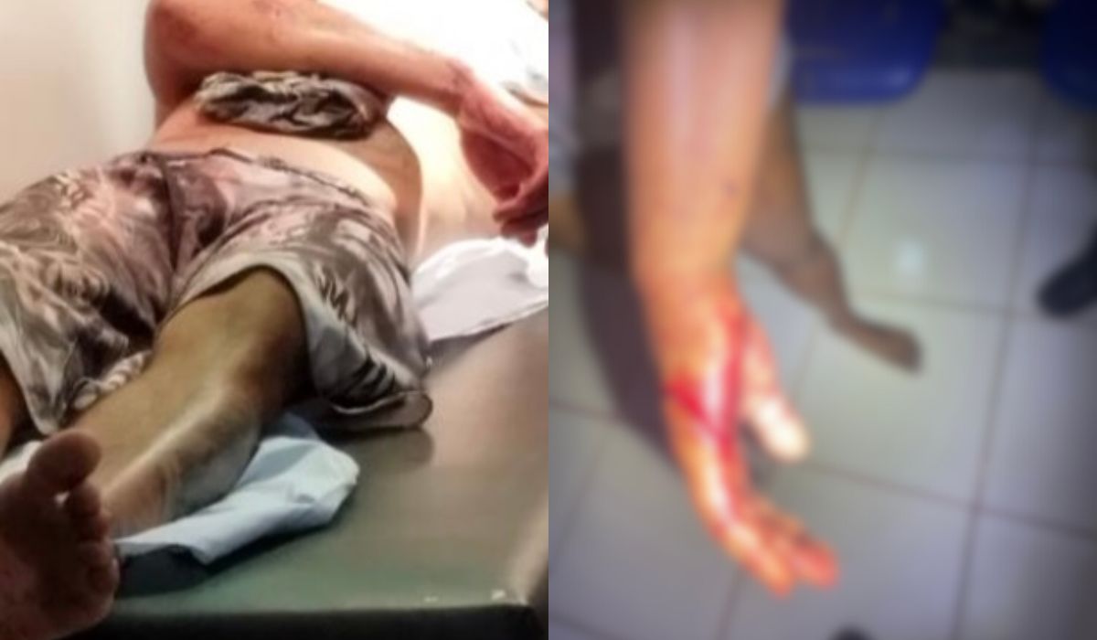Confusão em condomínio de Anápolis: homem tenta matar o cunhado e também ataca a irmã durante surto
