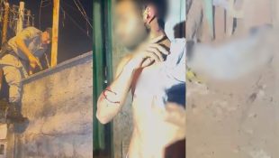 Pitbull precisou ser sacrificado para que vítima fosse socorrida. (Foto: Reprodução)