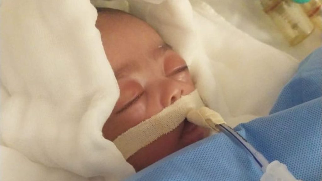 Bebê está em estado gravíssimo no Hugol. (Foto: Nayara Rodrigues)