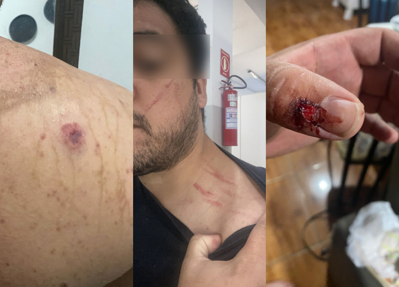 Fotos mostram que advogado que levou tapa durante audiência do TJGO também já foi espancado