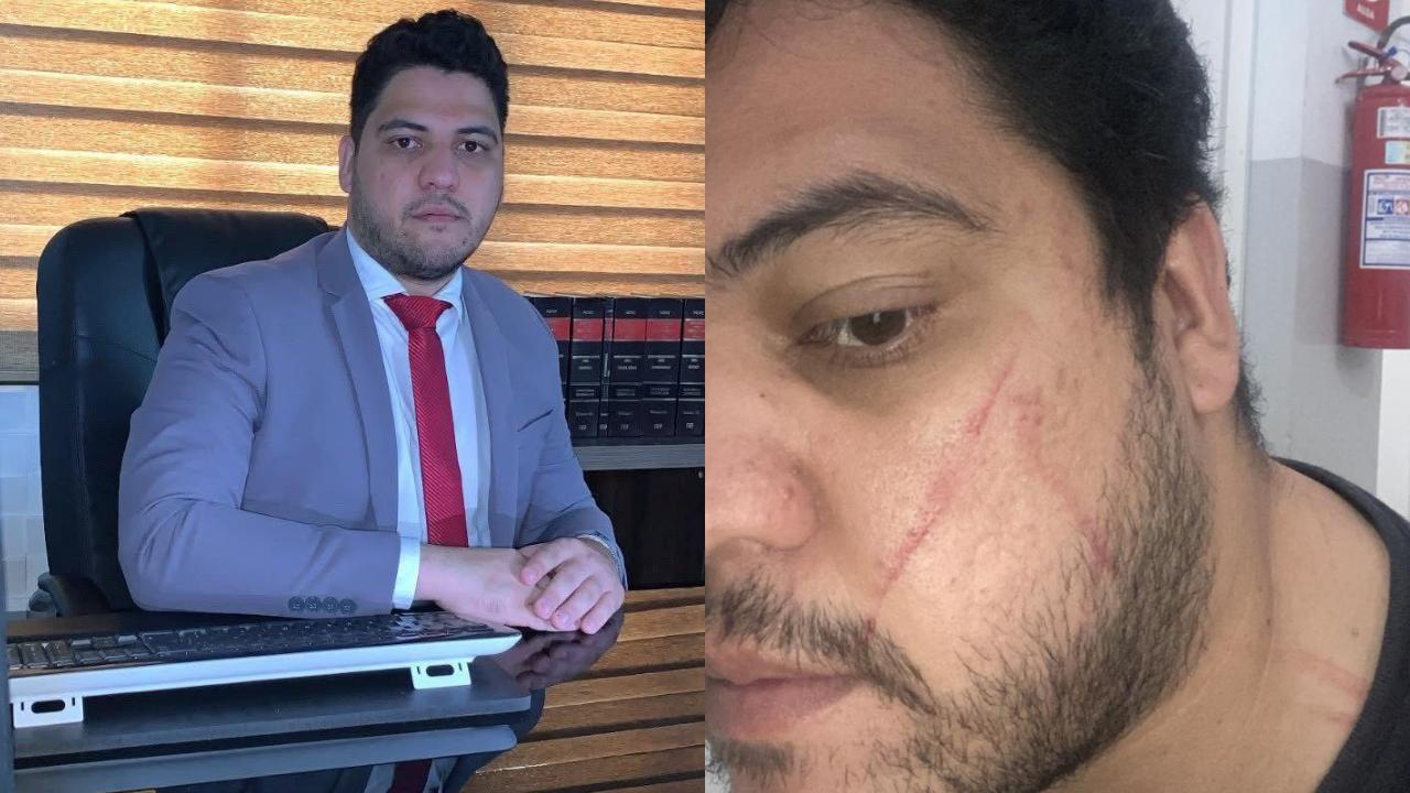 Advogado agredido durante audiência do TJGO tem 3 pedidos de prisão negados pela Justiça