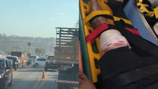 Piloto da moto teve perna perfurada em decorrência do acidente. (Foto: Reprodução)