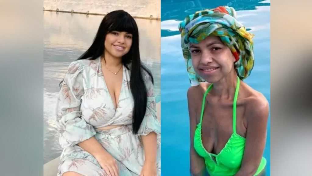 O forte relato da brasileira que precisou ter que reverter a bariátrica