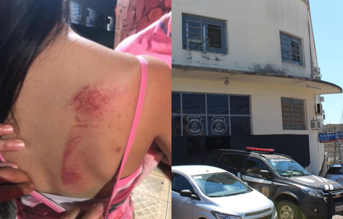 Jovem é preso em Anápolis após agredir esposa grávida durante discussão
