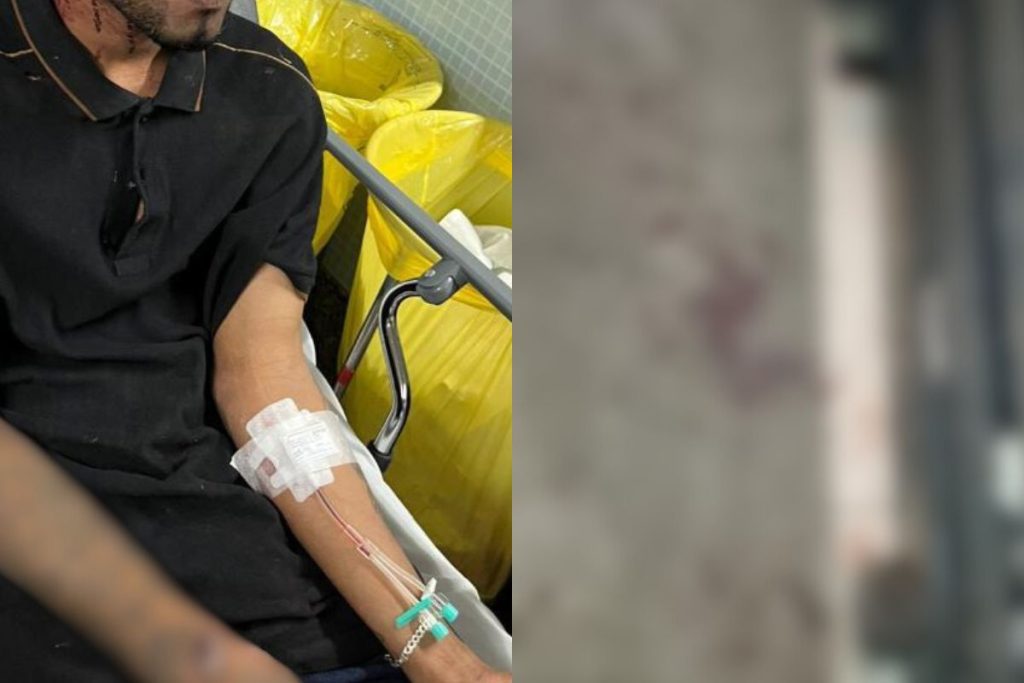 Jovem sofre emboscada violenta de torcida organizada em Goiânia após sair do trabalho