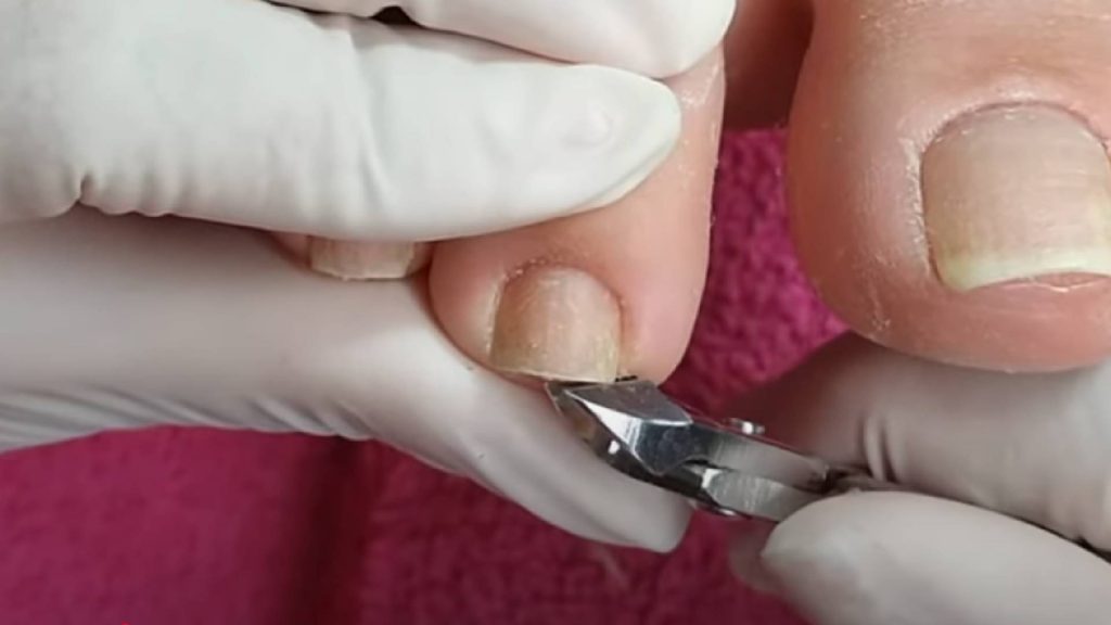 Por que cortar as unhas muito curtas pode ser prejudicial, segundo podólogos