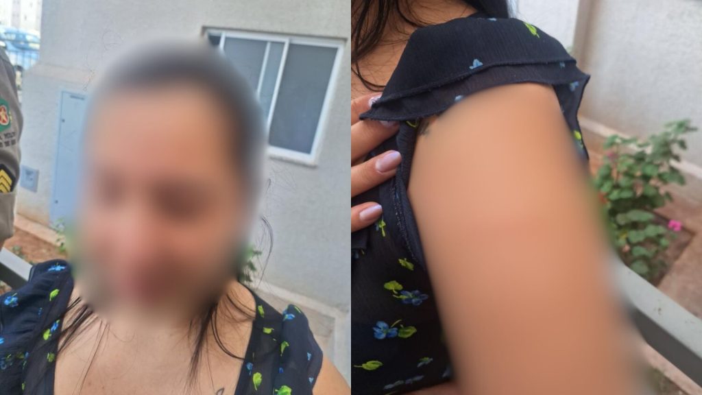 Vítima agredida por vizinha acionou a Polícia Militar e mostrou os ferimentos. (Foto: Reprodução/ PMGO)