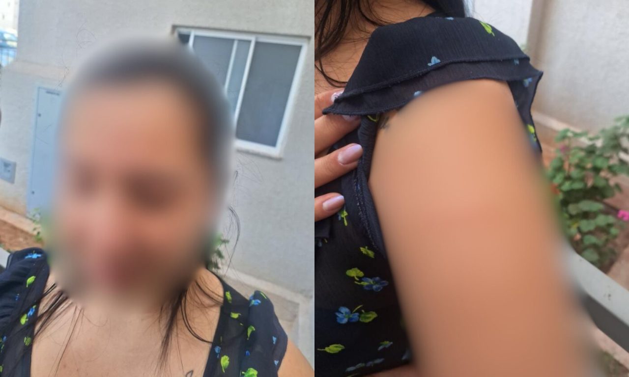 Vítima agredida por vizinha acionou a Polícia Militar e mostrou os ferimentos. (Foto: Reprodução/ PMGO)
