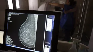 Ministério da Saúde passa a recomendar mamografia a partir dos 40 anos