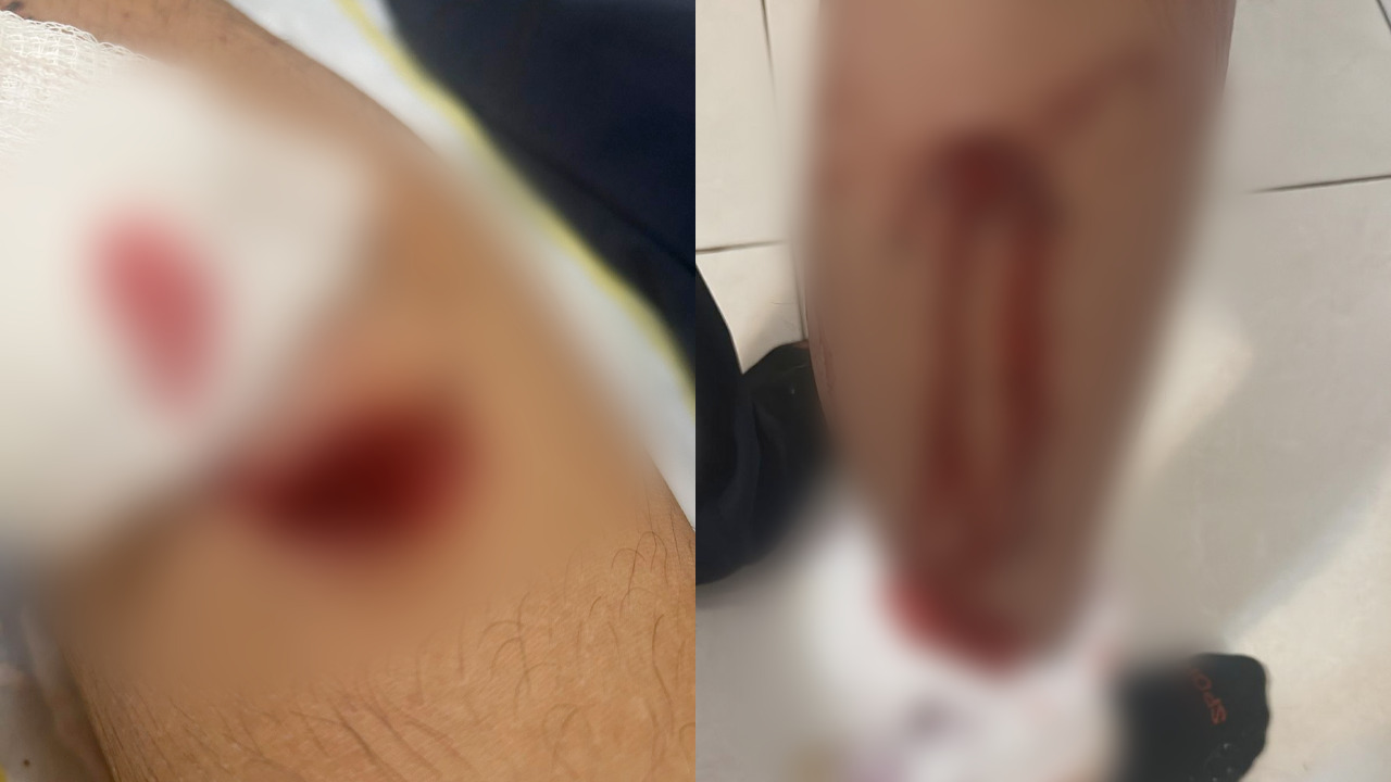 Adolescente é perseguido e atacado por macaco no Central Parque enquanto voltava da escola
