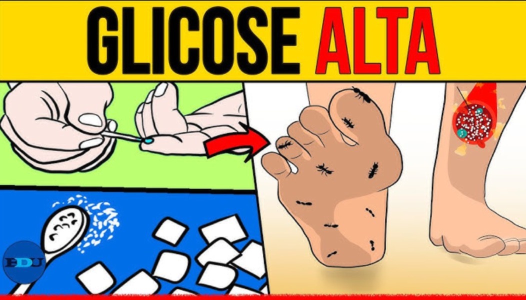 6 sinais de glicose alta que passam despercebidos, segundo médicos