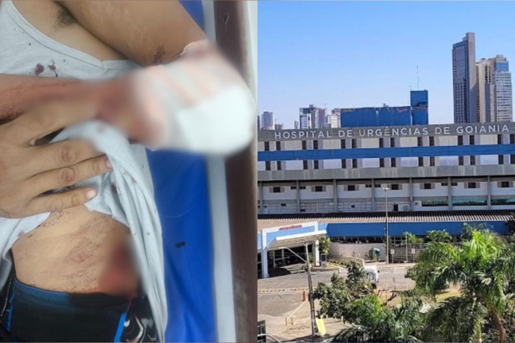 Jovem é esfaqueado e mulher agredida até desmaiar em forró de Goiânia; suspeito foi preso