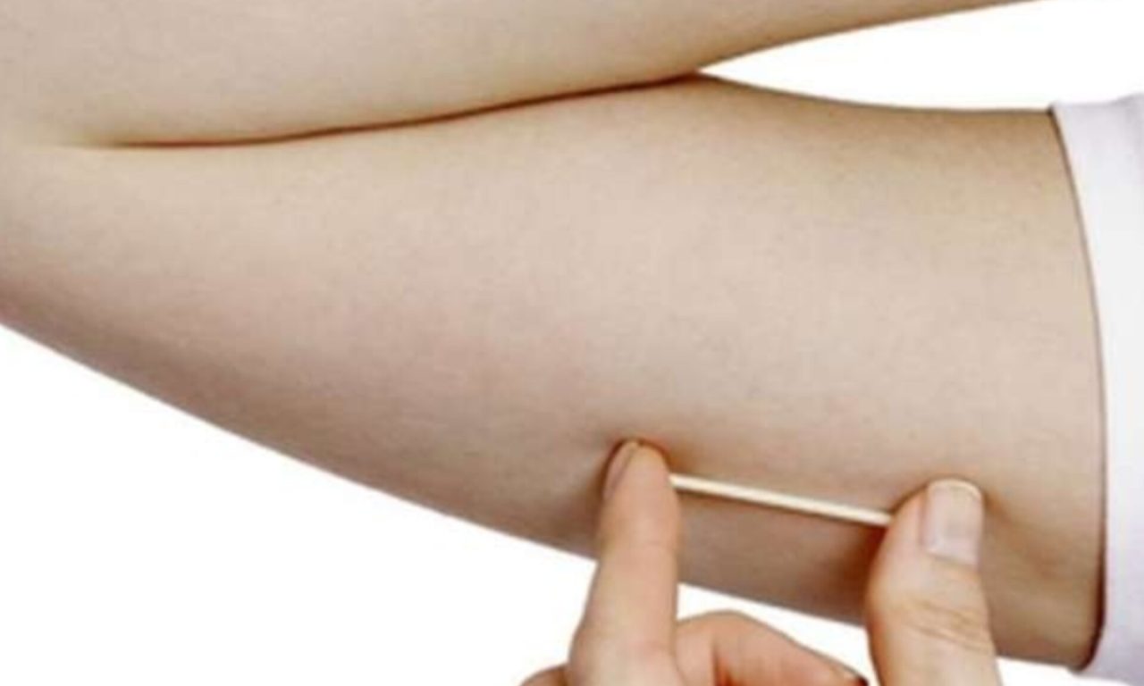 Implante contraceptivo deve ser ofertado por planos de saúde. (Foto: Reprodução)