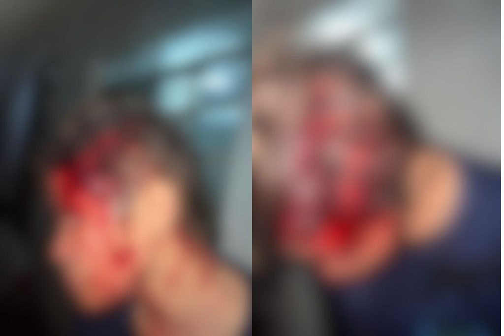 Mulher é esfaqueada na cabeça após briga com vizinha em Goiânia