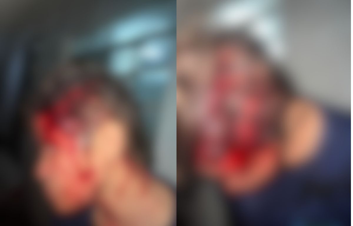 Mulher é esfaqueada na cabeça após briga com vizinha em Goiânia