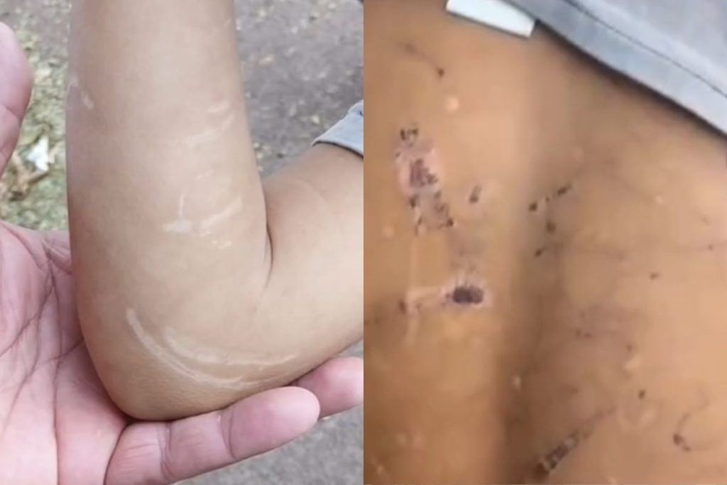 Crianças que estavam sendo espancadas e torturadas pelo pai são regatadas pela PM e Conselho Tutelar em Goiânia