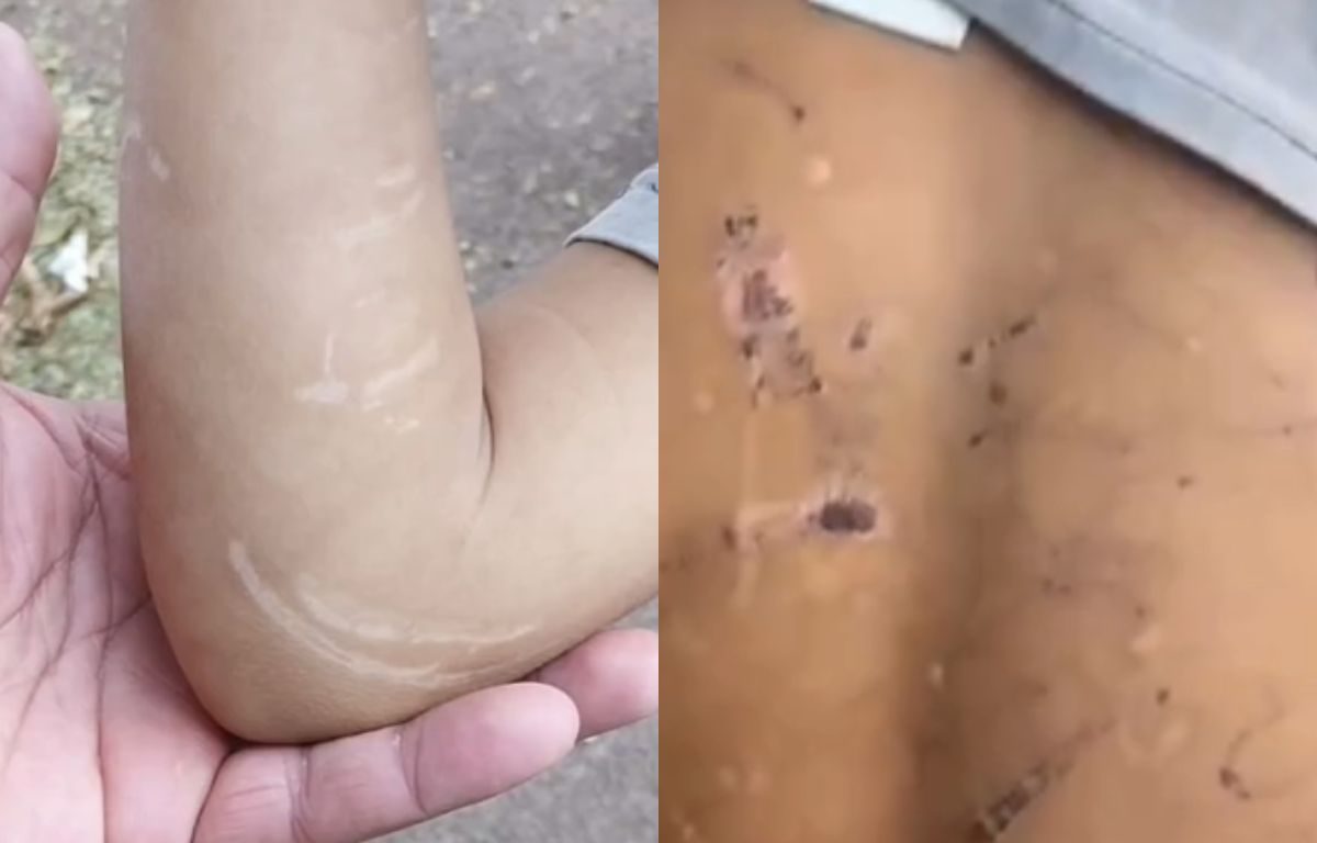 Crianças que estavam sendo espancadas e torturadas pelo pai são regatadas pela PM e Conselho Tutelar em Goiânia