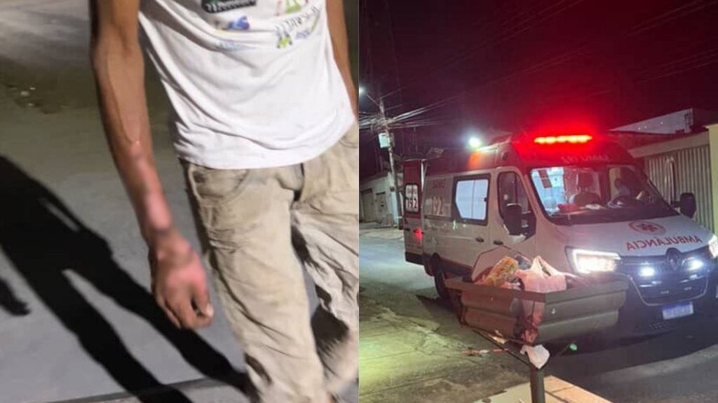 Homem sofreu queimaduras após a explosão.