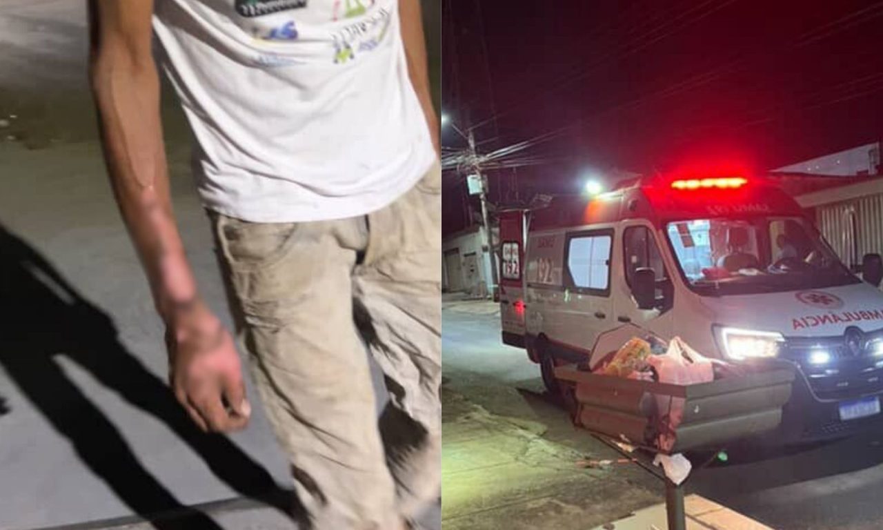 Homem sofreu queimaduras após a explosão.