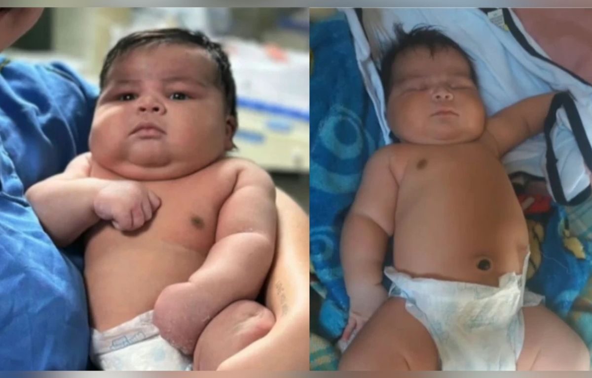Bebê pesando 6,5 kg nasce de parto normal e mãe precisa levar 55 pontos