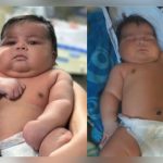Bebê pesando 6,5 kg nasce de parto normal e mãe precisa levar 55 pontos