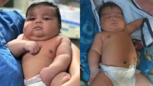 Bebê pesando 6,5 kg nasce de parto normal e mãe precisa levar 55 pontos