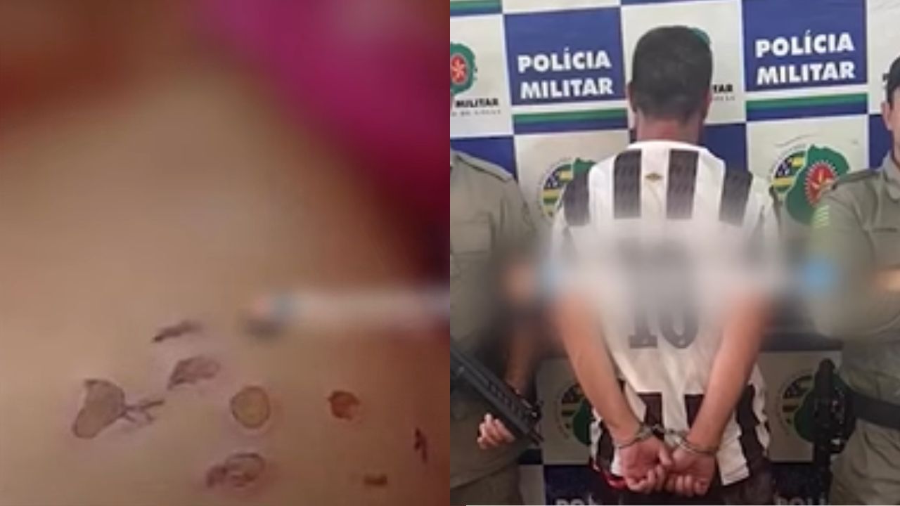 Padrasto é preso por suspeita de queimar bebê de 10 meses com cigarro no interior de Goiás