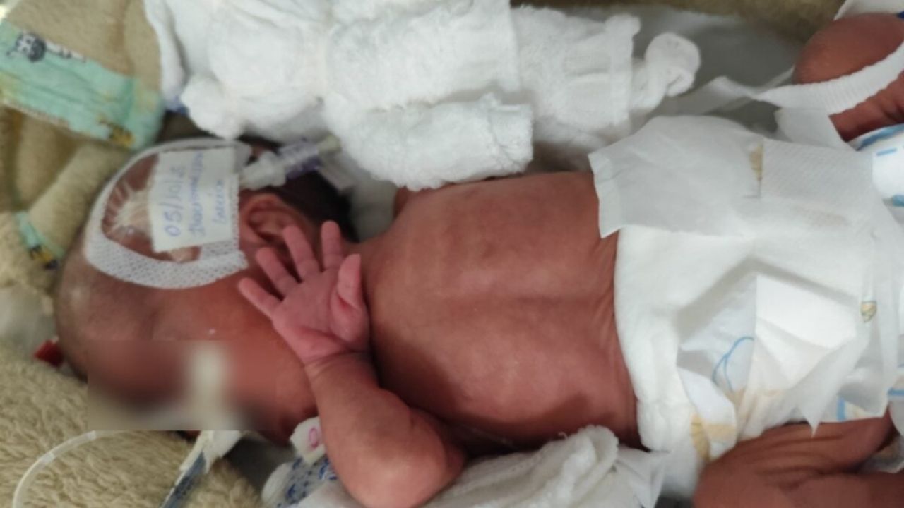 Bebê em estado crítico aguarda transferência para fazer cirurgia no Hospital das Clínicas, em Goiânia