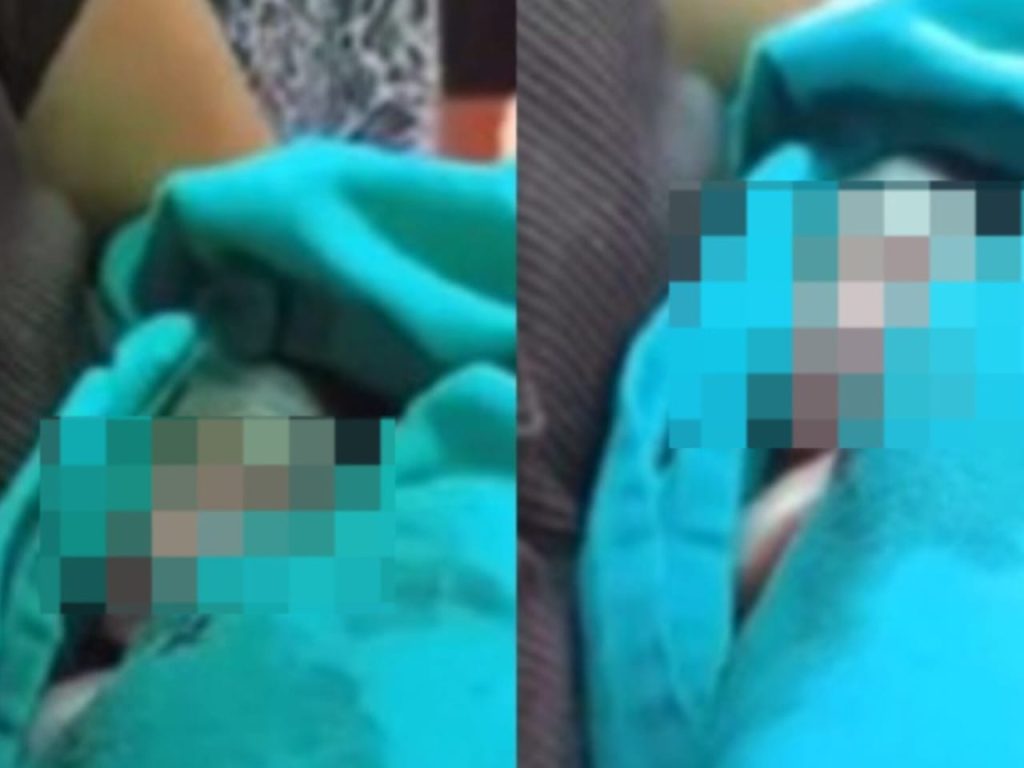 Família percebeu que bebê estava vivo após ouvir choro de dentro do caixão. (Foto: Reprodução)