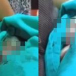 Família percebeu que bebê estava vivo após ouvir choro de dentro do caixão. (Foto: Reprodução)