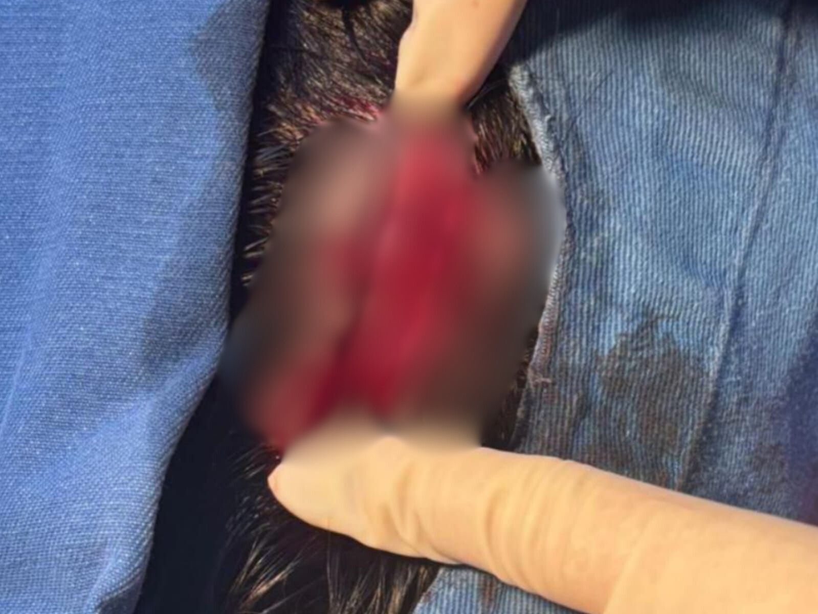 Vítima sofreu um extenso corte na cabeça. (Foto: Reprodução)