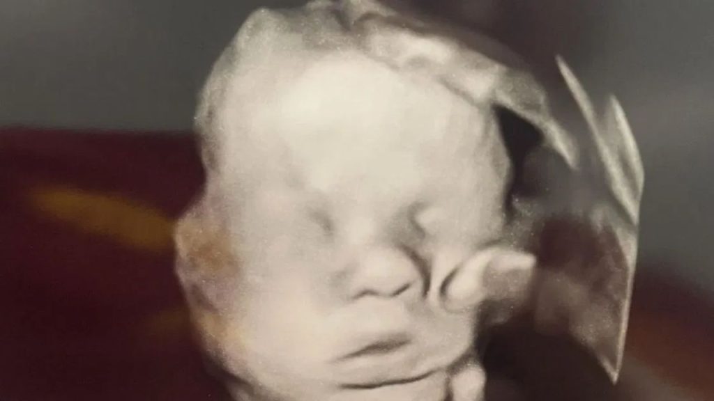 Mãe se ajoelha para orar dentro do hospital e “mão de Deus” aparece sobre o bebê na ultrassom
