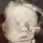 Mãe se ajoelha para orar dentro do hospital e “mão de Deus” aparece sobre o bebê na ultrassom