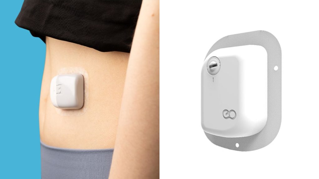 Pâncreas artificial é só o começo: Anvisa aprova a menor bomba de insulina do mundo