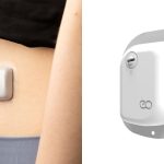 Pâncreas artificial é só o começo: Anvisa aprova a menor bomba de insulina do mundo