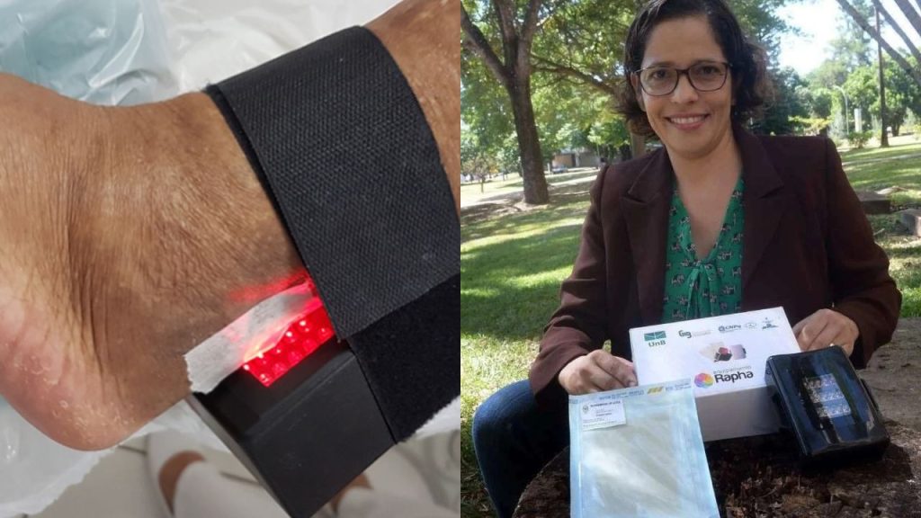 Brasileira cria aparelho capaz de acelerar a cicatrização de feridas em diabéticos e evitar amputações