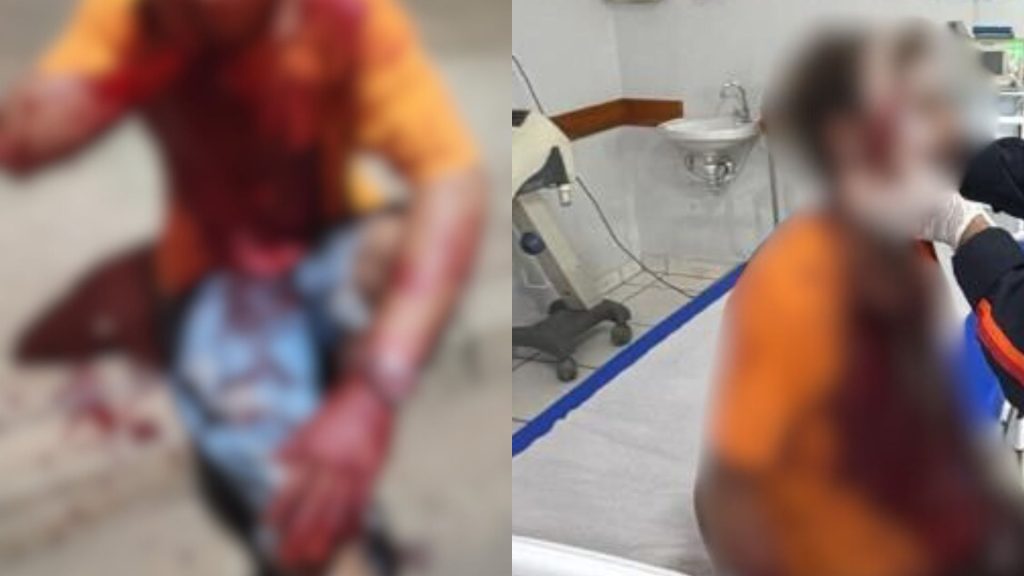Jovem ficou totalmente ensanguentado após as agressões.