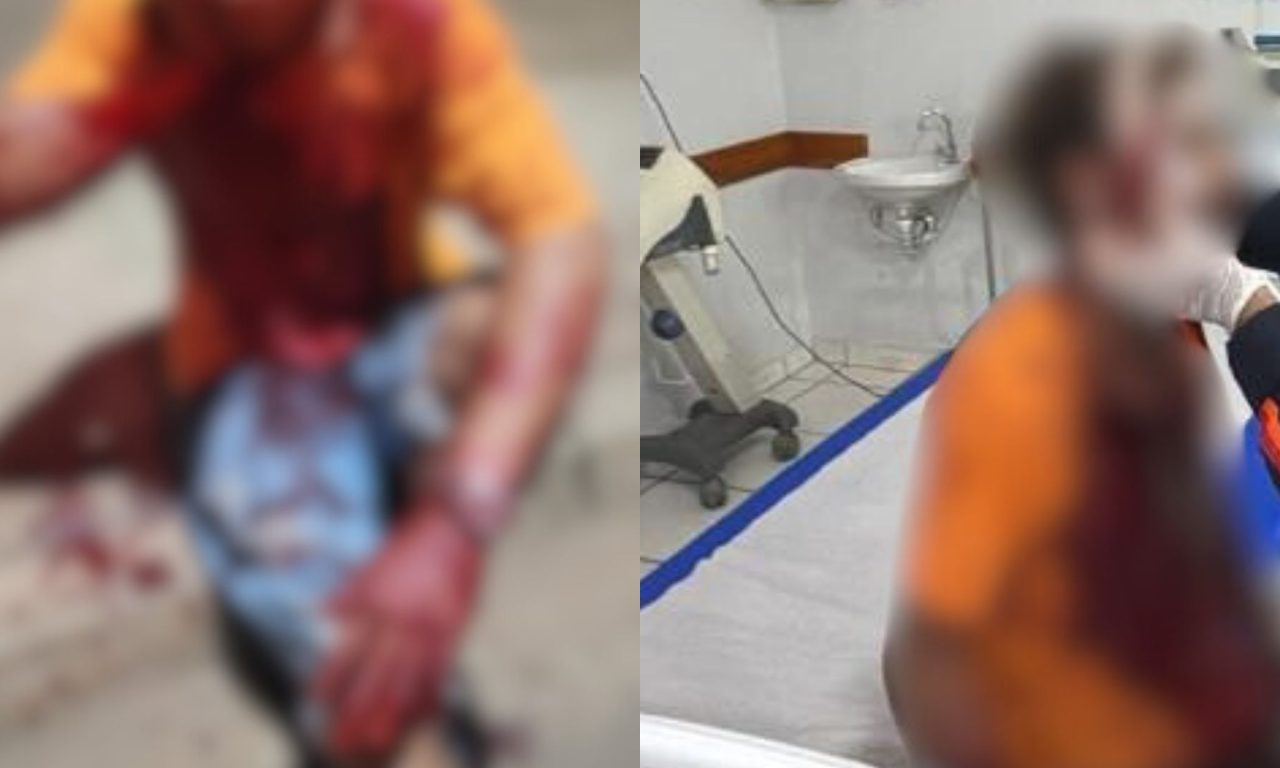 Jovem ficou totalmente ensanguentado após as agressões.