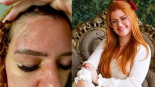 Influenciadora sofre queimaduras após explosão de panela de pressão em Valparaíso de Goiás