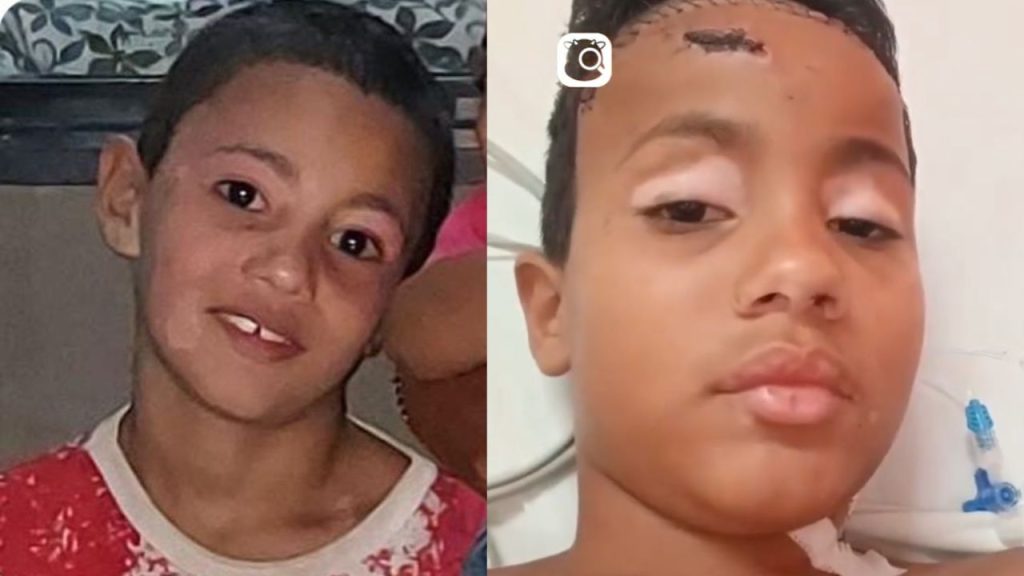Menino agredido por grupo em Caldas Novas acorda do coma e agradece orações