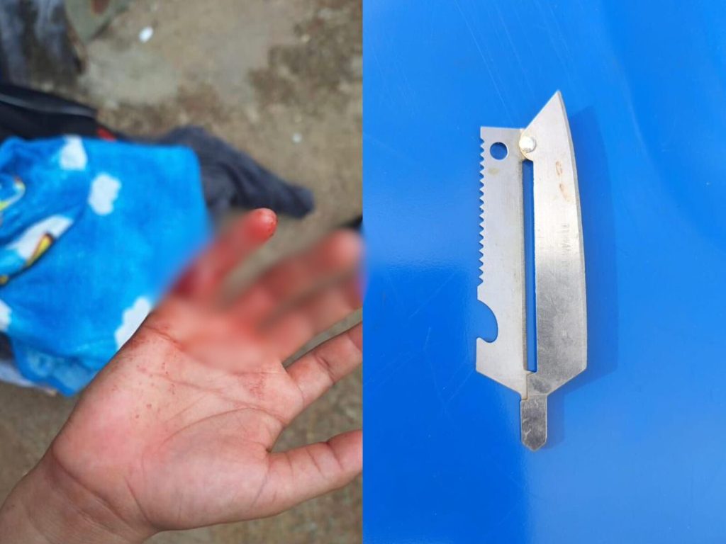 Padrasto utilizou um objeto perfurocortante para decepar dedo do enteado. (Foto: Divulgação/PM)