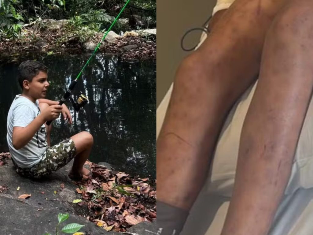 João Pedro não resistiu e morreu no hospital em decorrência do ataque das abelhas. (Foto: Reprodução/G1)