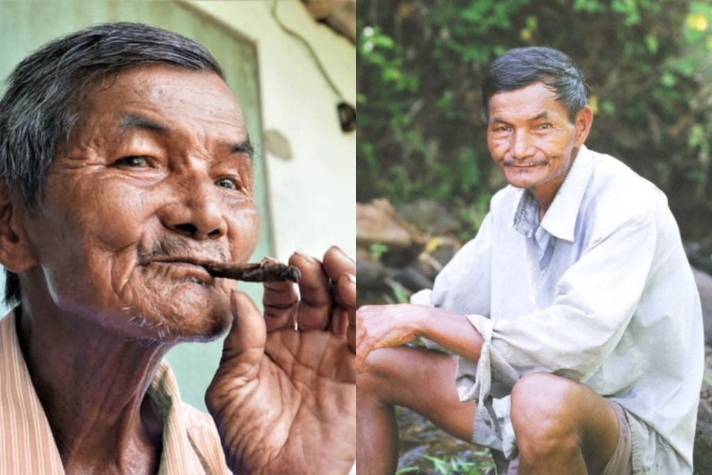 Homem de 80 anos que não consegue dormir desde 1962