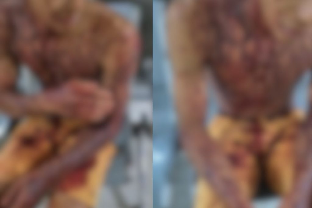 Jovem fica coberto de sangue após enfrentar usuários de drogas para proteger família, em Senador Canedo