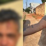 “Vou beber seu sangue”: mulher invade casa do ex, quebra portão e o agride com tijoladas, em Trindade