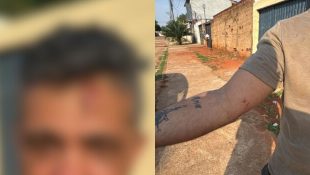 “Vou beber seu sangue”: mulher invade casa do ex, quebra portão e o agride com tijoladas, em Trindade