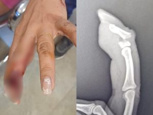 Mulher relatou ter sido agredida pelo ex após se recusar a sair para comprar cigarros. (Foto: Reprodução)