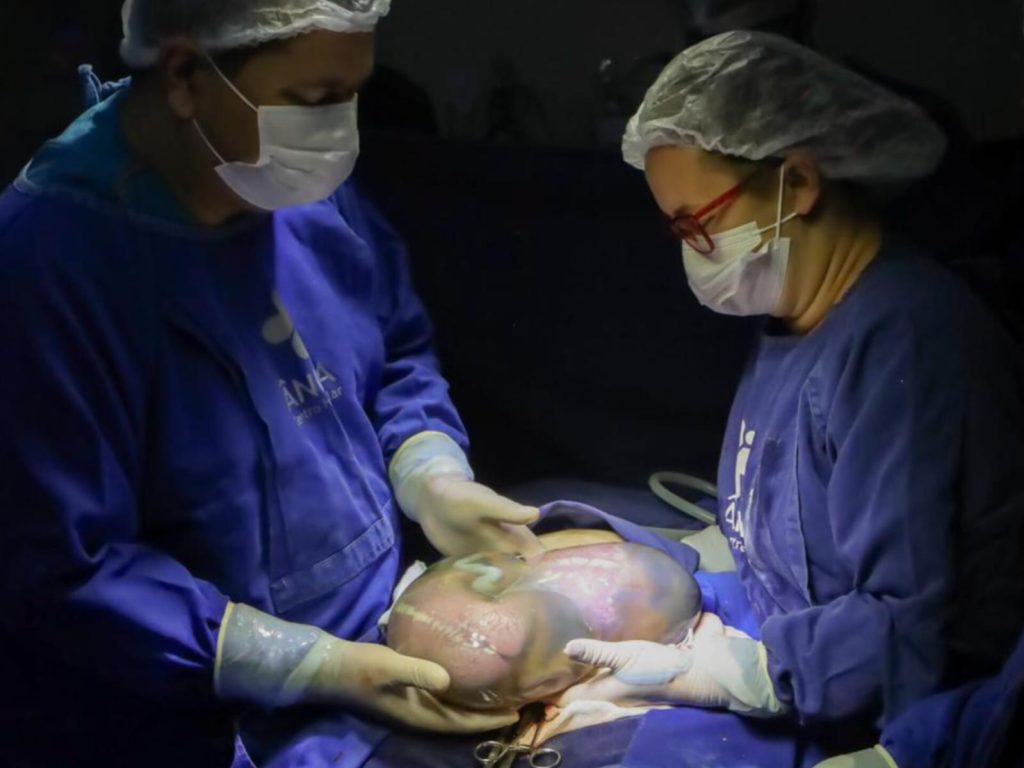Dois dos trigêmeos vieram ao mundo empelicados. (Foto: Placenta ainda com os cordões umbilicais ligados. (Foto: @carol_telesphotos) )