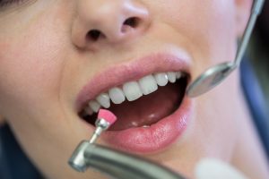 Cientistas alemães descobrem como restaurar esmalte dos dentes