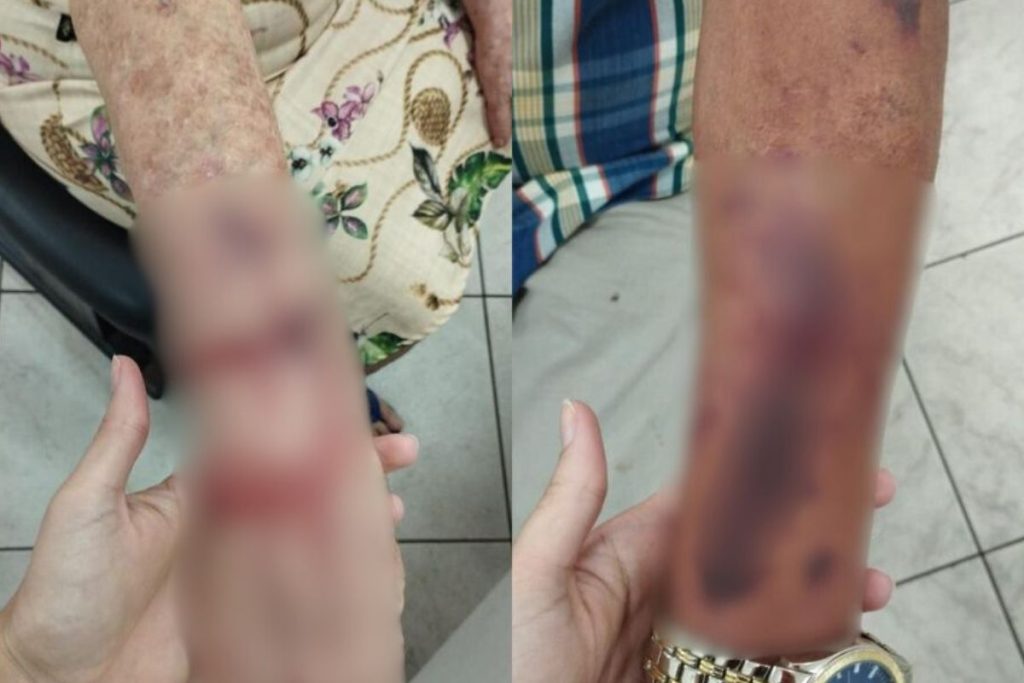 Vizinha surta, agride idosa com tamanco e ameaça: “não vai ser na faca, vai ser na bala”, em Aparecida de GoiâniaVizinha surta, agride idosa com tamanco e ameaça: “não vai ser na faca, vai ser na bala”, em Aparecida de Goiânia